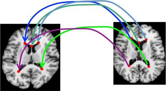 Appariement de primitives entre deux images.