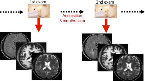 Change detection in medical imaging.