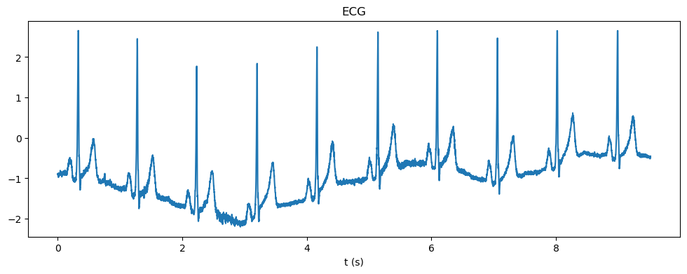 <Figure size 1200x400 with 1 Axes>