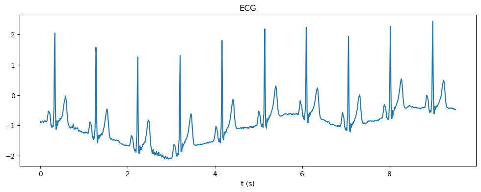 <Figure size 1200x400 with 1 Axes>